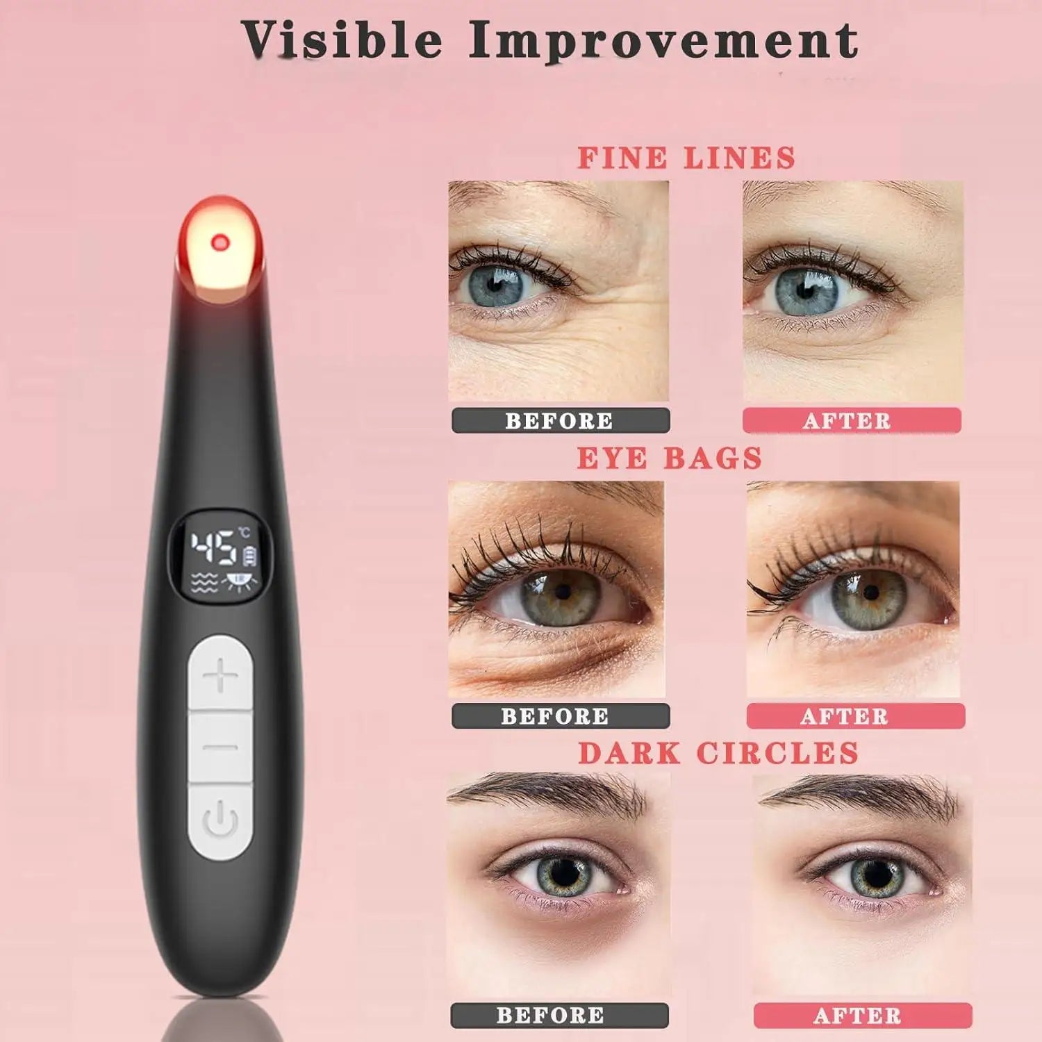 Radiant Eyes Beauty Device