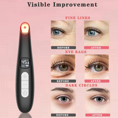 Radiant Eyes Beauty Device